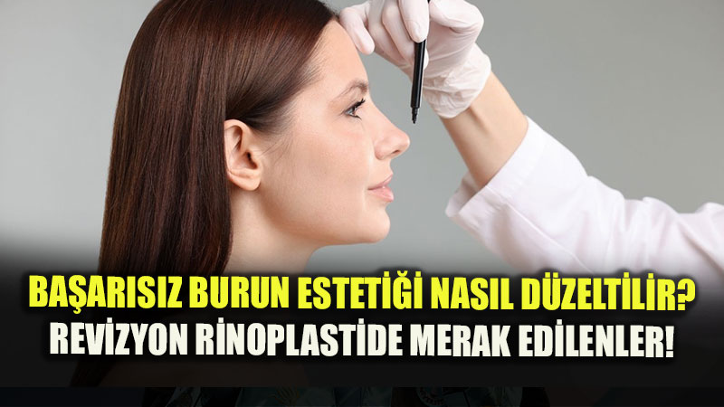 Dr. Yunus Kaplan�dan Revizyon Rinoplasti Uyar�s�: "Her Memnuniyetsizlik �kinci Bir Ameliyat Gerektirmez"