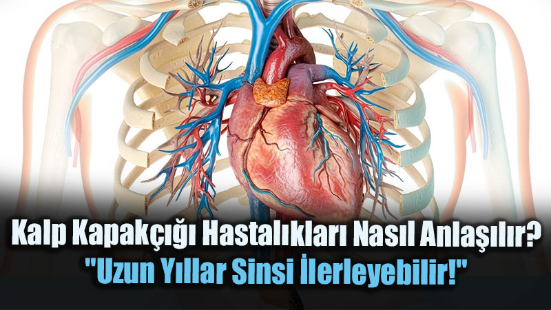 Nefes Darl��� Ve �arp�nt�ya Dikkat: Kalp Kapak Hastal�klar�nda �lk Belirtiler Ve Tan� Rehberi